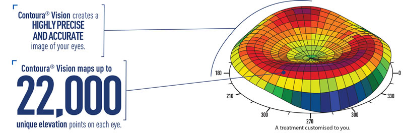 Contoura Vision map